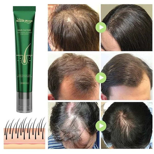 Made Chic Boutique 20ml Biotin Fast Hair Growth Oil Hair Regrowth Serum Hair Thinning Treatment Hair Growth Liquid Anti-Hair Loss For Women and Men 2023