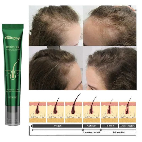 Made Chic Boutique 20ml Biotin Fast Hair Growth Oil Hair Regrowth Serum Hair Thinning Treatment Hair Growth Liquid Anti-Hair Loss For Women and Men 2023
